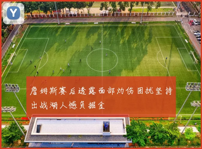 詹姆斯赛后透露面部灼伤困扰坚持出战湖人憾负掘金